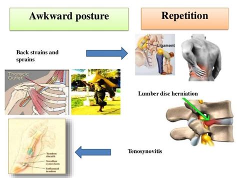 Work Related Musculoskeletal Disorders