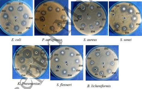 Zone Of Inhibition Exhibited By Nanoparticles Zs And Zs Against Human