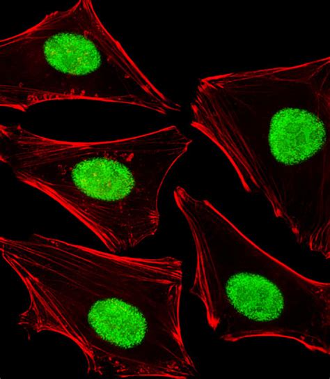 Poldip Antibody Unconjugated Rabbit Polyclonal Biozol