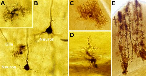 Protoplasmic Astrocytes