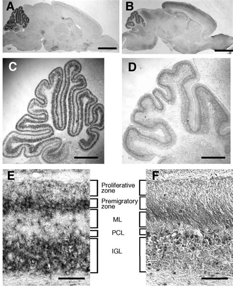 Expression Of Caps Mrna And Protein In P Mouse Brains A C E In