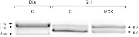 Typical Electrophoretic Profiles Of Myosin Heavy Chain Mhc In Control