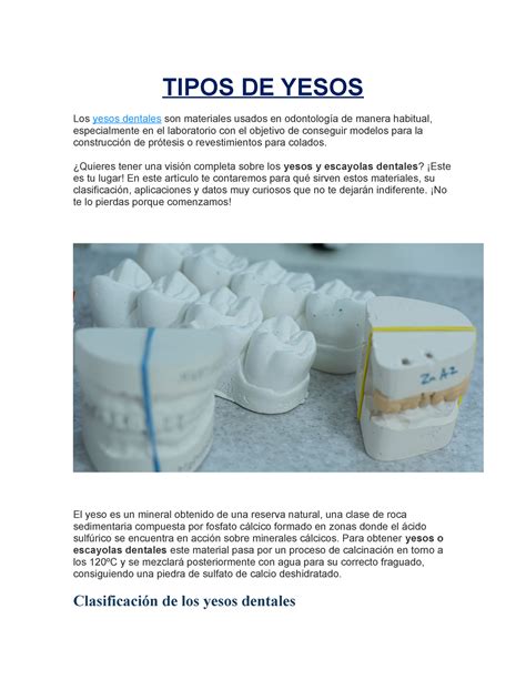 Tipos De Yesos Tipos De Yesos Los Yesos Dentales Son Materiales