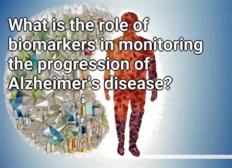 What is the role of biomarkers in monitoring the progression of Alzheimer’s disease ...