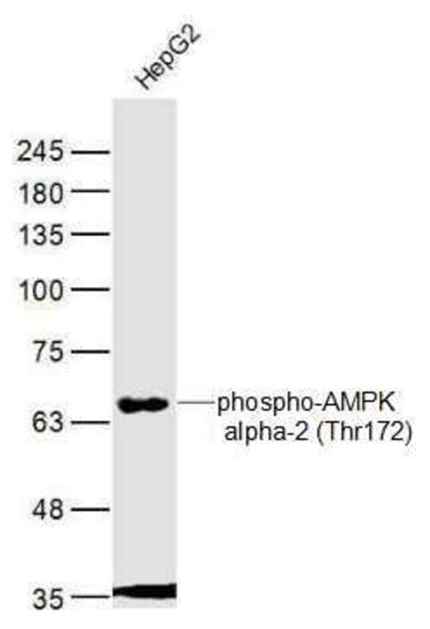 Phospho Ampk Alpha Thr Thr Rabbit Anti Human Polyclonal