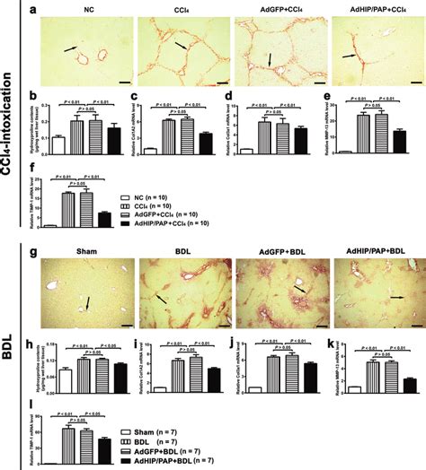 HIP PAP Attenuates CCl 4 And BDL Induced Hepatic Fibrosis In Mice