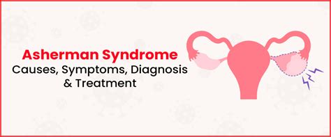 Asherman Syndrome Causes Symptoms And Treatment