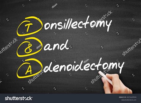 Tonsillectomy Adenoide Behind Nose Over 4 Royalty Free Licensable