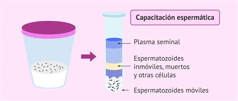 C Mo Es El Proceso De La Fecundaci N In Vitro Paso A Paso