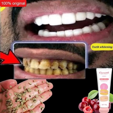 Ubat Gigi Teeth White Teeth Whitening Ubat Gigi Ukiwi Toothpaste