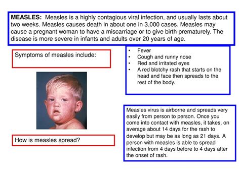 PPT - Symptoms of measles include: PowerPoint Presentation, free ...