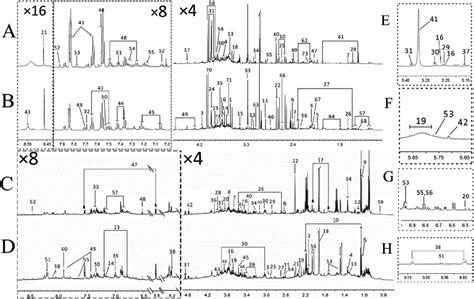 Typical 600 MHz ¹H NMR spectra of urine from FD group A control