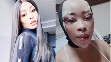 Khanyi Mbau Trends After Undergoing Surgery Again H Metro