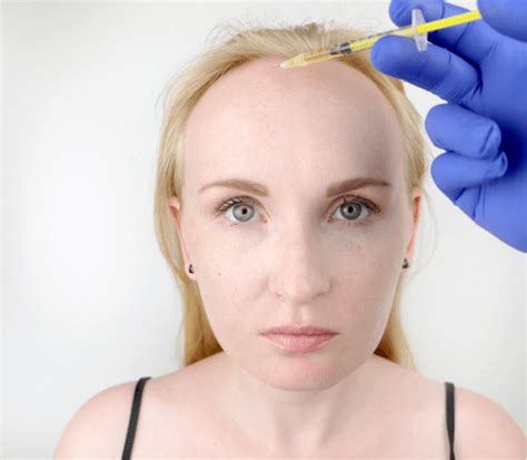 HAIR TRANSPLANTATION IN WOMEN | Long Hair Center | Long Hair Center