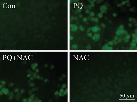 Nac Treatment Reduces Intracellular Ros Level And P Mapk Activation