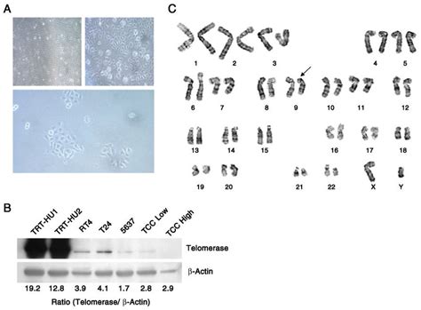 Validation Of Htert Mediated Immortalization In Primary Urothelial