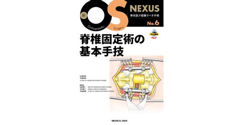 メジカルビュー社｜脳神経外科｜新os Nexus No6 脊椎固定術の基本手技 Web動画付