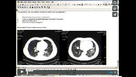 2012 Case Studies Thyroid Cancer | American Thyroid Association