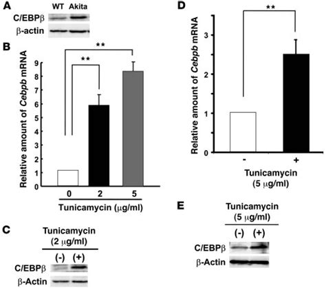 JCI Ablation of C EBPβ alleviates ER stress and pancreatic β cell