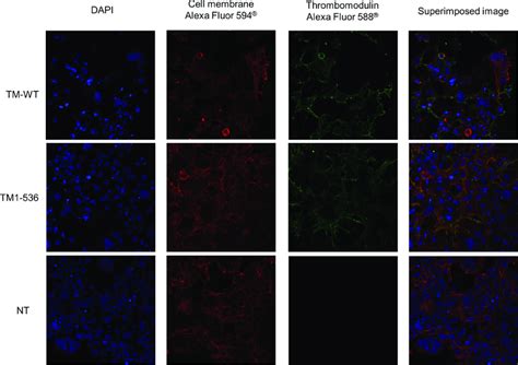 Cell Surface Thrombomodulin Immunofluorescent Labelling And Confocal