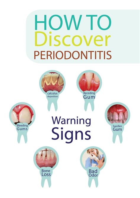 Info Graphics For Periodontal Diseases Prevention On Behance