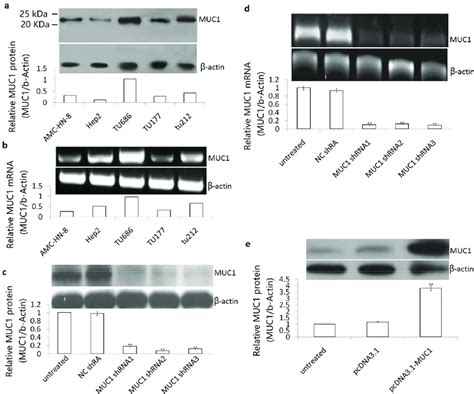 Effect Of ShRNA Or Plasmid Transfection On MUC1 Expression In LSCC