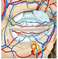 Infraorbital nerve - e-Anatomy - IMAIOS