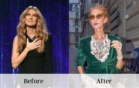 Celine Dion Weight Loss Reality: How Is Her Health in 2023?