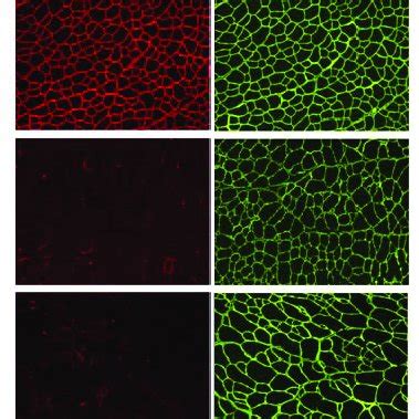 In Vivo Genome Editing With Cjcas In Ta Muscles Of Dmd Knockout Mice