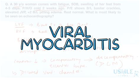 Viral Myocarditis Dr Sweta Yadav USMLE Step 2CK YouTube