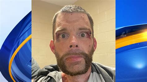 Mcso Man Charged With Assault After Biting Deputy While In Custody