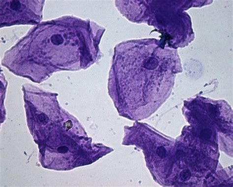 Medical School • Human Cheek Cells as seen in an electron...