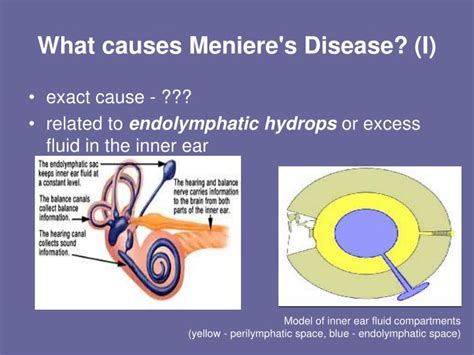 Meniere's Syndrome Caused By Exercise | Paul Smith