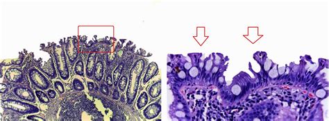 GASTROINTESTINAL AND LIVER HISTOLOGY PATHOLOGY ATLAS: COLON ...