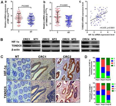 Role Of Txndc In Tumorigenesis Of Colorectal Cancer Cells In Vivo And