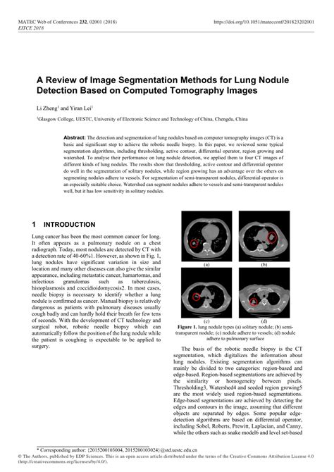 PDF A Review Of Image Segmentation Methods For Lung Nodule Detection