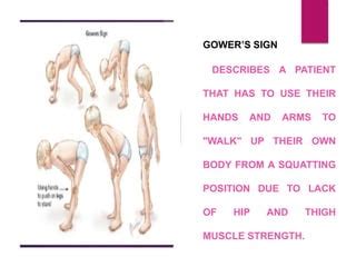 Gowers Sign