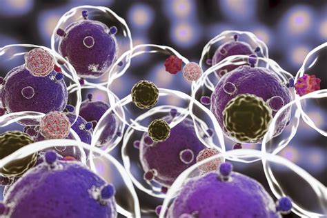 Small Intestinal Bacterial Overgrowth Sibo Causes Symptoms Mevian