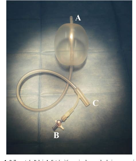 Figure 1 From Bakri Balloon Semantic Scholar