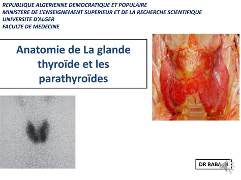 Solution Anatomie De La Glande Thyroide Studypool