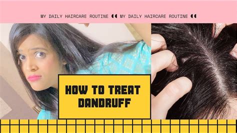 How To Get Rid Of Dandruff Dandruff Home Remedy