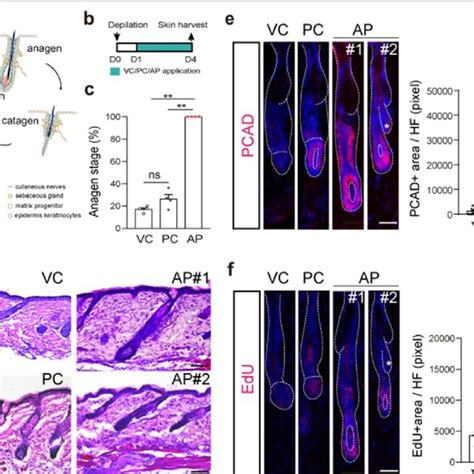 AP drives anagen entry. a Hair follicle cycle diagram. b Experimental ...