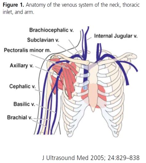 Central Venous Line Anatomy Central Venous Access Via Supraclavicular