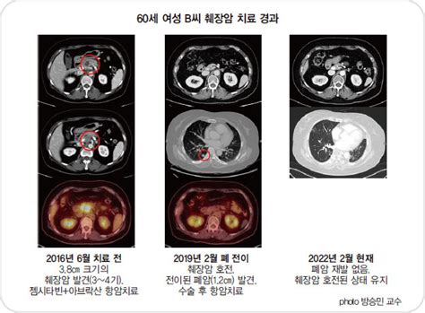 新명의열전② 췌장암 세브란스병원 소화기내과 방승민 교수