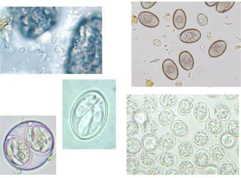 36 Cryptosporidium Flashcards Quizlet