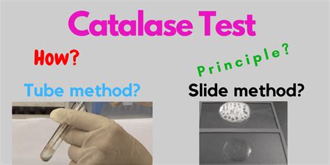 Catalase Test Introduction Principle Procedure Result Images And