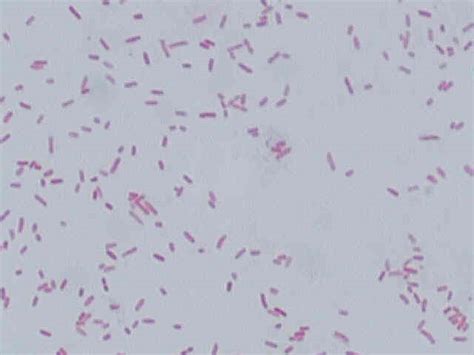 Pseudomonas Aeruginosa Gram Stain Morphology