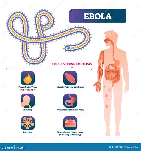 Ebola Vector Illustration. Labeled Virus Bacteria Infection Symptoms ...