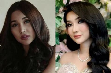 Berubah Drastis Ini Potret Perbandingan Wajah Lucinta Luna Dulu Dan