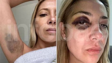 Aparecieron las primeras fotos de Fabiola Yañez golpeada